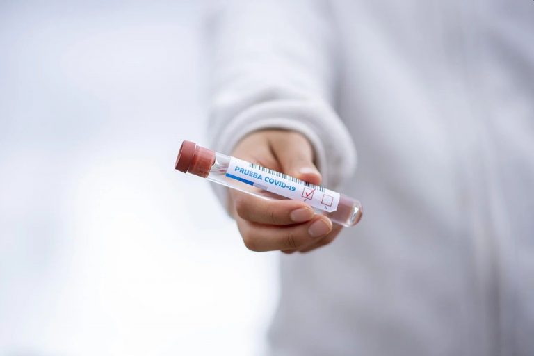 Osoby na kwarantannie mogą zrobić test w mobilnym punkcie pobrań. Na jakich warunkach?
